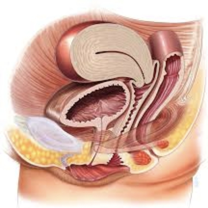 Gynekologiset laskeumat